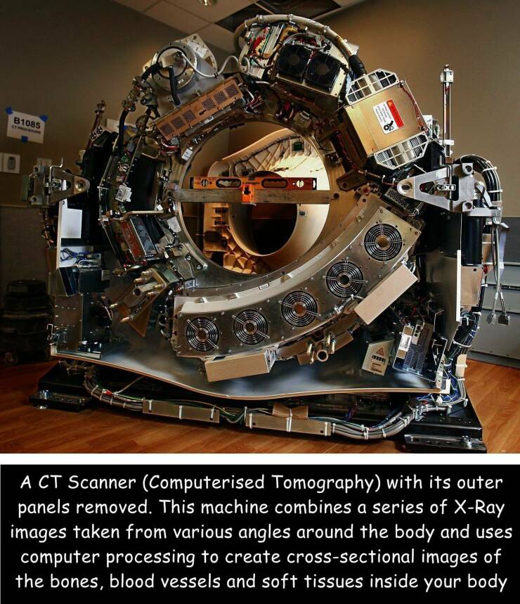 cool pics - ct scan inside - B1085 Chcel 161 www A Ct Scanner Computerised Tomography with its outer panels removed. This machine combines a series of XRay images taken from various angles around the body and uses computer processing to create crosssectio