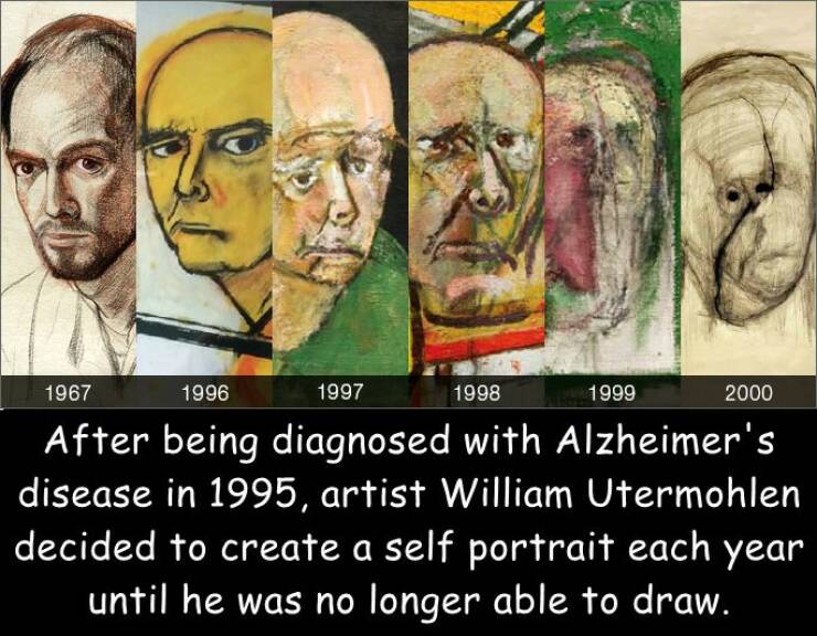 cool random pics - artist with alzheimer's self portrait - 1967 1996 1997 1998 After being diagnosed with Alzheimer's disease in 1995, artist William Utermohlen decided to create a self portrait each year until he was no longer able to draw. 1999 2000