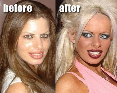 plastic surgery before and after - before after