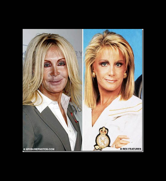 Joan Van Ark I don't know which one it the "Before" or "After"