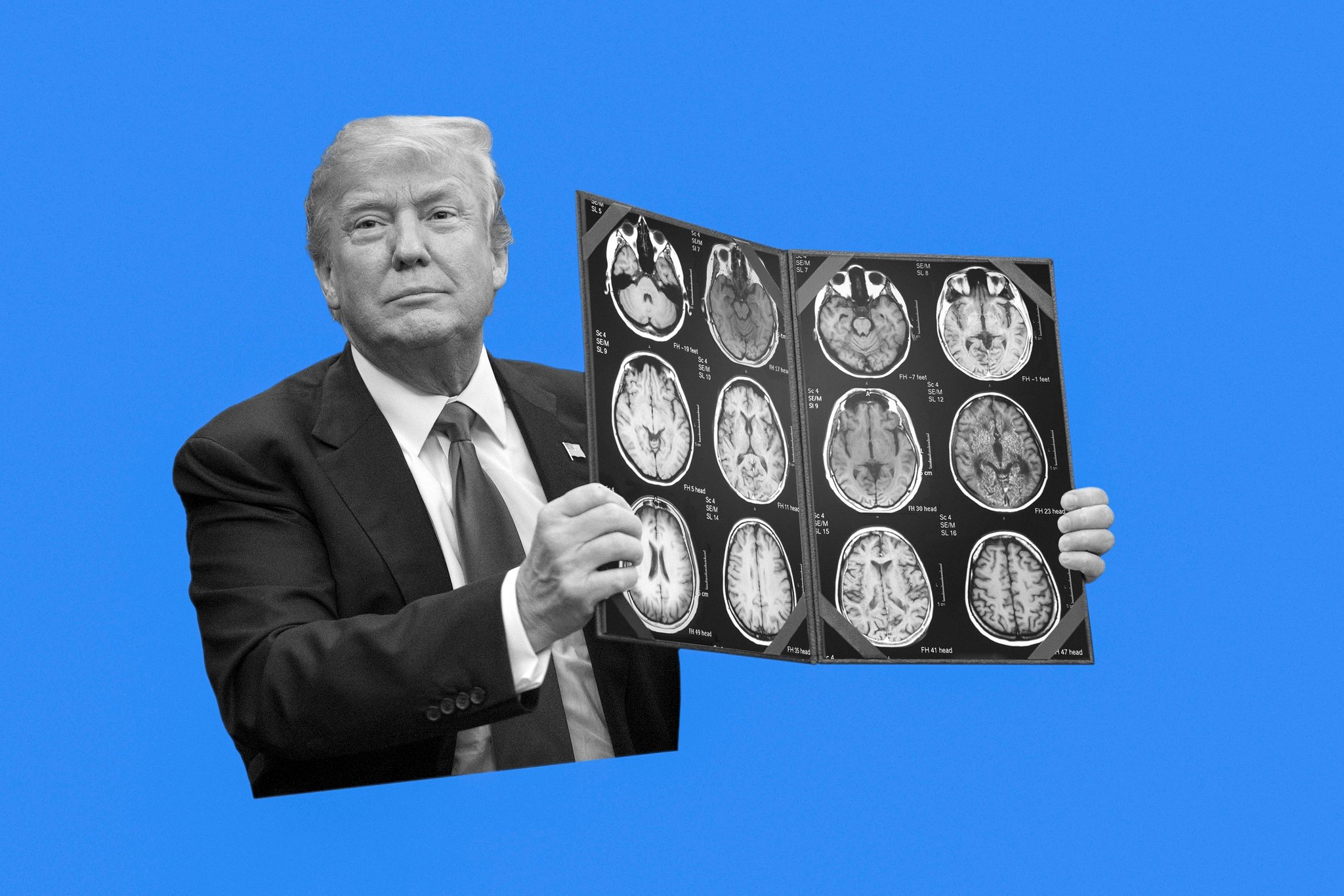 Black areas clearly show neuropsychiatric condition - mental disorders; the ability to work. pathological lying, extreme narcissism, adult temper tantrums, not realizing what one says - flip flops - from one moment to the next, signs of dementia/alzheimers.