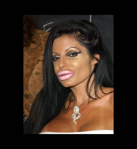 Plastic Surgery Pictures That Will Scare You