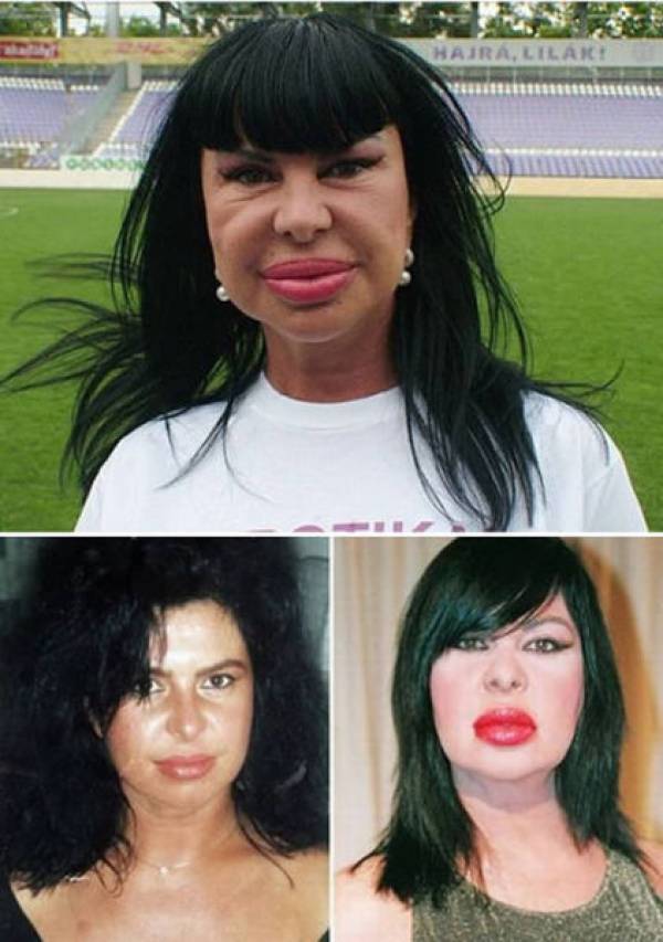 Creepy Plastic Surgery And Body Enhancement Pictures