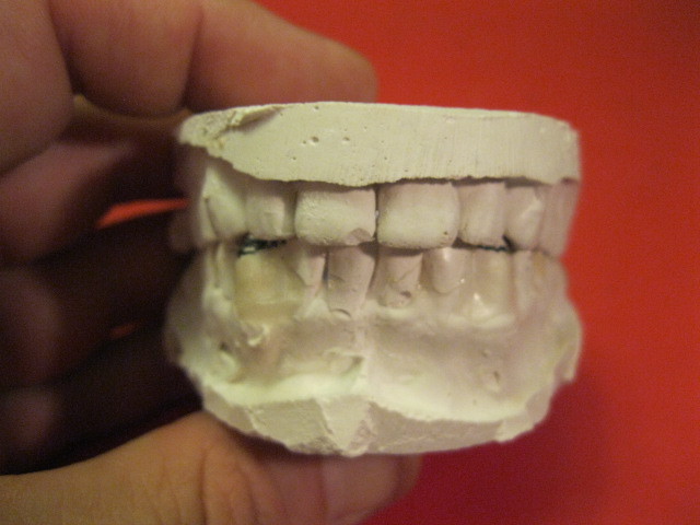 vintage DENTIST TEETH MOLD FROM REAL PATIENT me!  neat realism