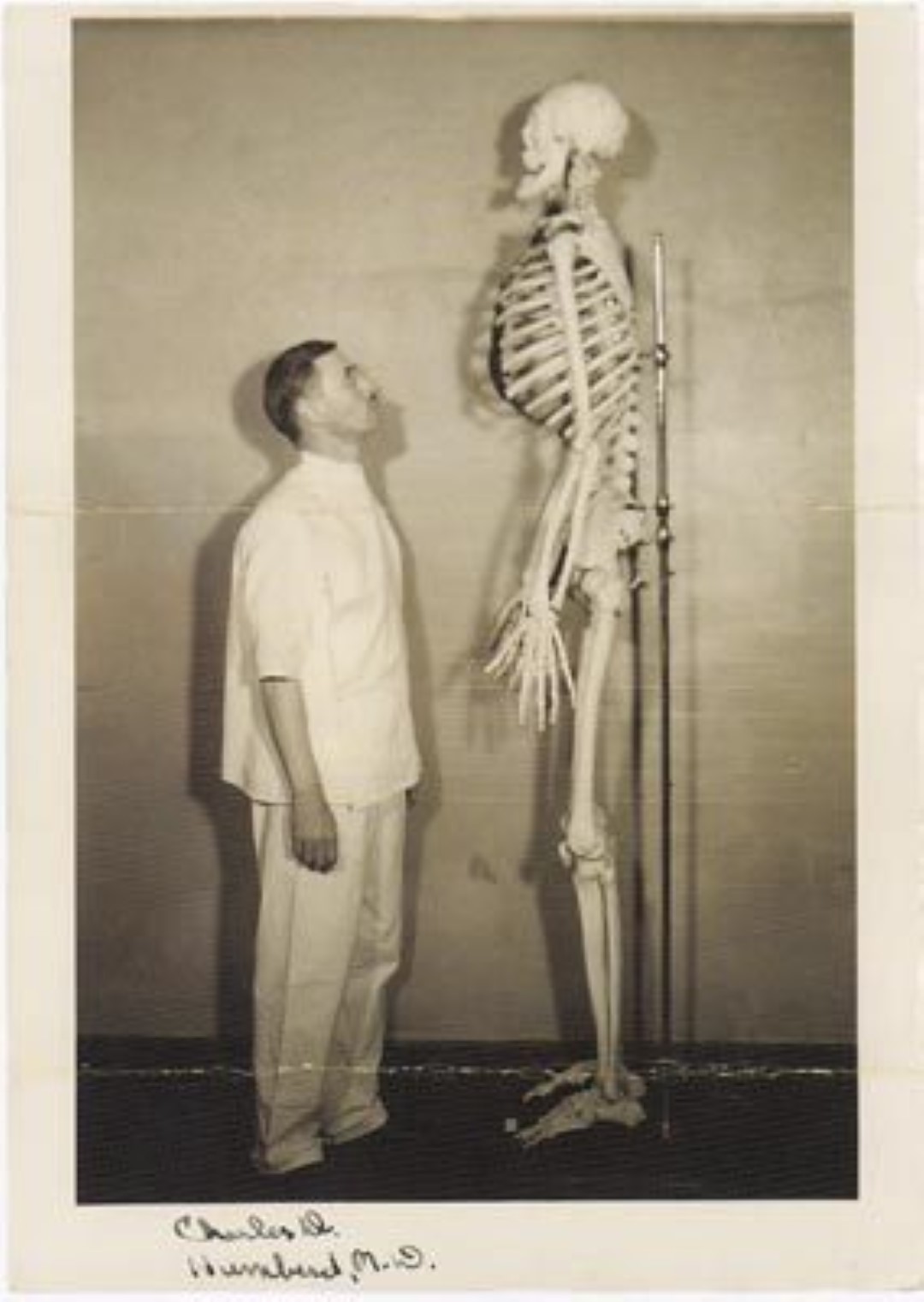 Giant Humans - This is the skeleton of John Aasen (1890-1938) who was employed in the circus as a sideshow freak. John was 7’1/2&#8243; (214cm) tall.