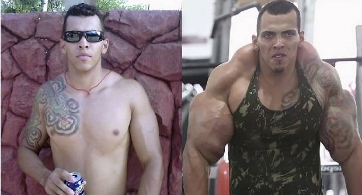 A Brazilian body builder injected muscle-enhancing supplements to look like the Hulk. Pretty neat,right?