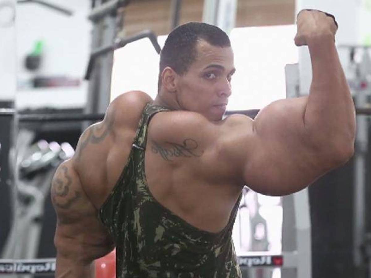 Romario learned about Synthol through his gym friends who had huge biceps.