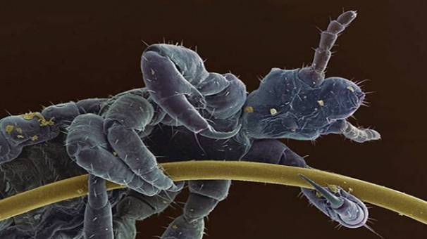 Head Louse Clinging To Human Hair