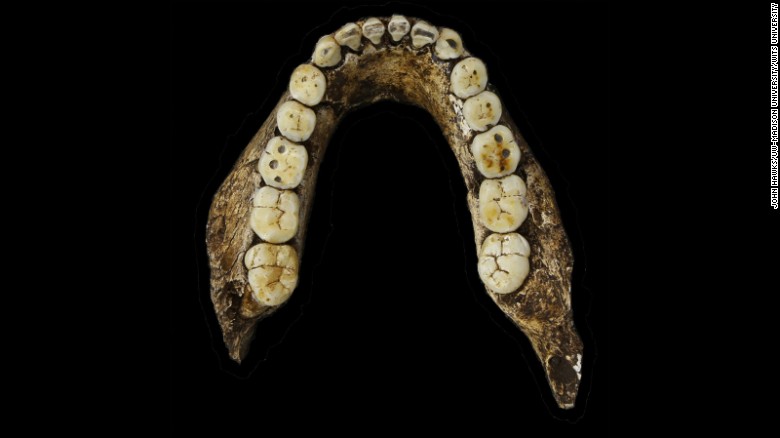 The teeth are similar to our primitive ancestors.