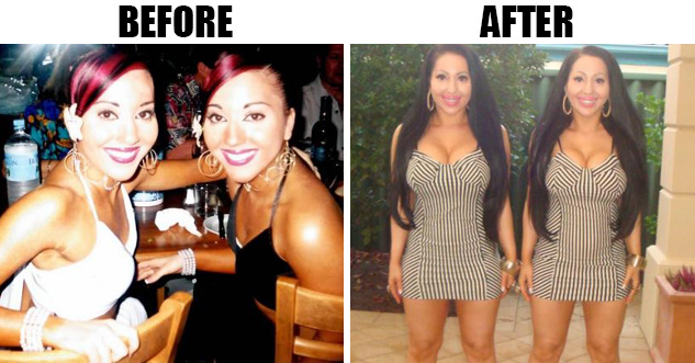 Do you think they look better before or after the countless medical procedures?
