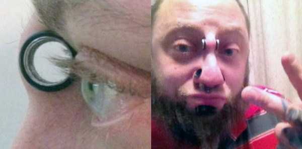 28 Bizarre Body Modifications That Will Make Your Cringe