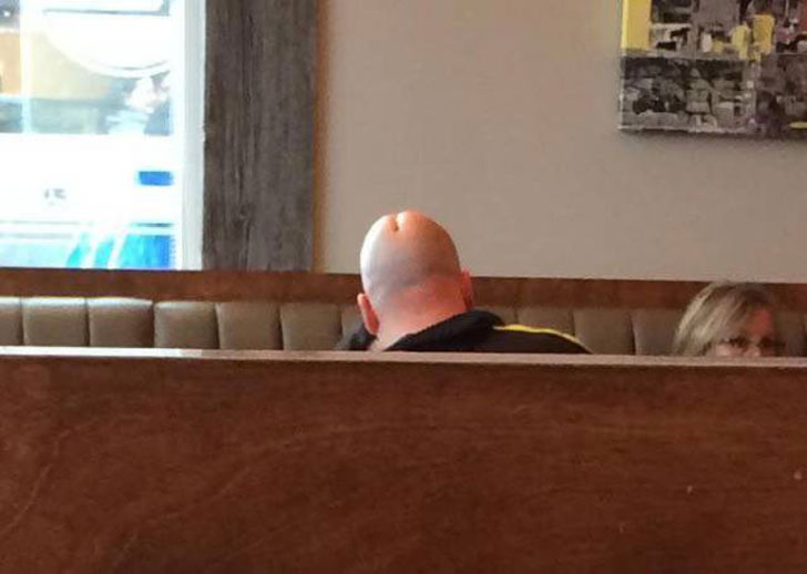 Bald man has scar that makes him look like a dick head