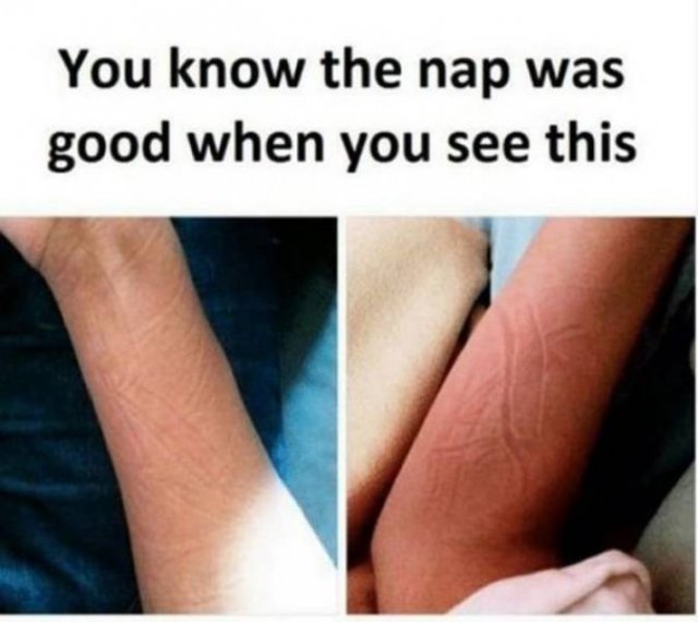 knee - You know the nap was good when you see this