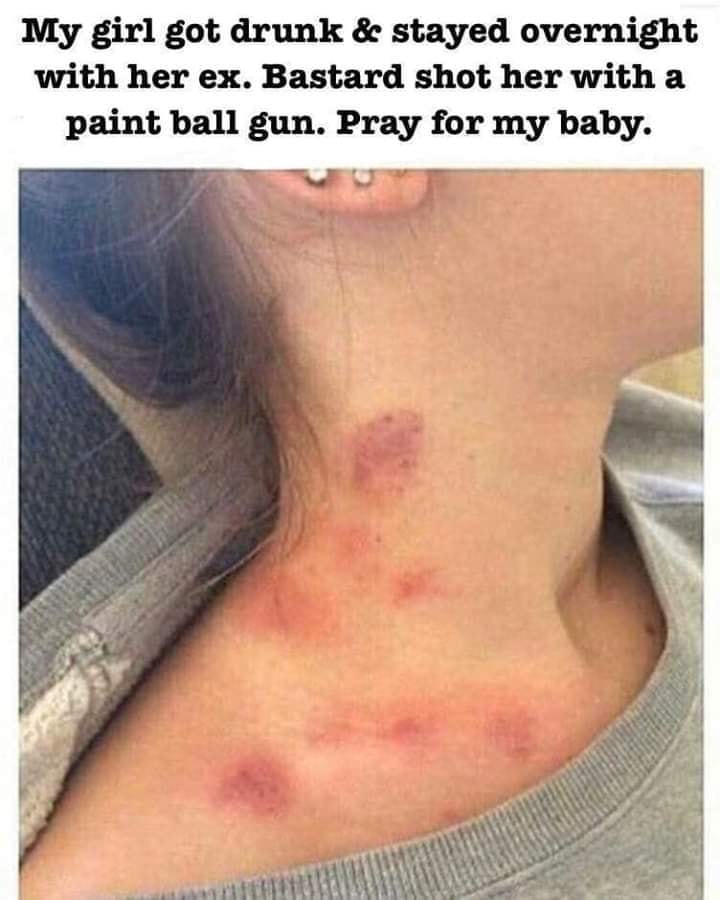my girl got drunk and stayed over - My girl got drunk & stayed overnight with her ex. Bastard shot her with a paint ball gun. Pray for my baby.