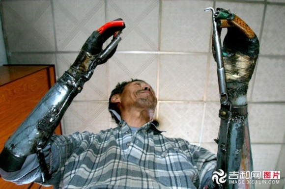 DIY Bionic Arms