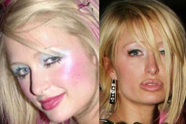 Bad Plastic Surgery