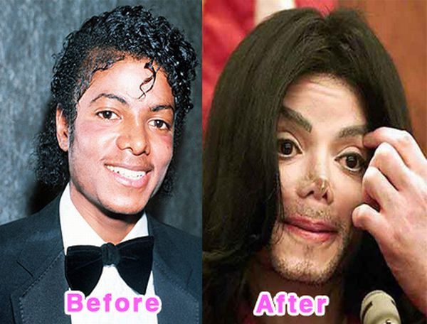 Bad Plastic Surgery