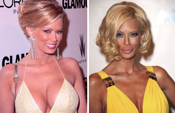 Bad Plastic Surgery