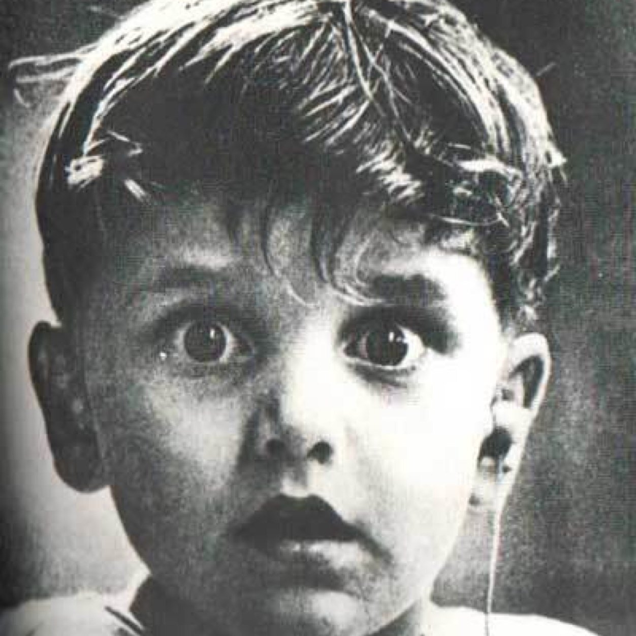 Harold Whittles hears for the first time ever after a doctor places an earpiece in his left ear.This photo was taken by photographer Jack Bradley, and depicts the exact moment when this boy,hears for the very first time ever.
