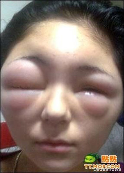 20 Crazy Bee Sting Faces