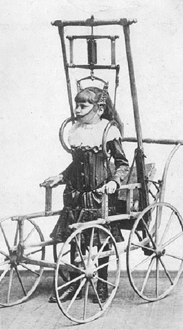 EARLY WHEELCHAIRS:     Dr Clarks Spinal Apparatus was advertised in 1878 as allowing people with spinal issues to walk for a few minutes  or even hours  a day. In actuality, the wooden frame on this terrifying device was so heavy that a medically fit person could barely move an inch, let alone those with spinal issues.