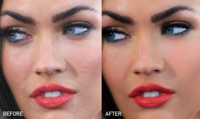 megan fox acne - Before After