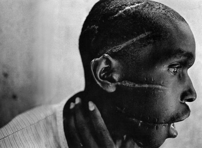 A Rwandan boy left scared after being liberated from a death camp.