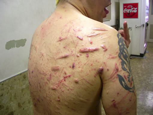 The back of Japanese Death match wrestler Jun Kasa