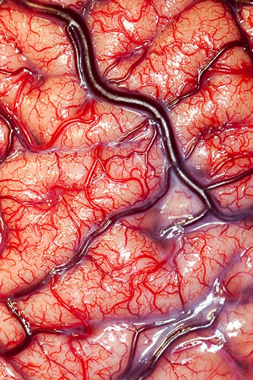 The surface of the human brain