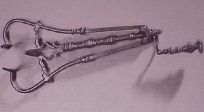 Vaginal Speculum 1600s: Specula have been used for thousands of years by doctors, mainly so that they could examine a womans vaginal area. This 17th century European example is ornate and intimidating, but is similar to the specula used today.