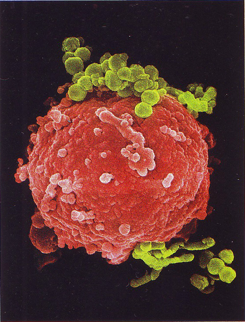 B-cell      latecomers in immunesystem evolution, B-cells, like this specimen covered with bacteria, produce armies of anti-bodies whose sole purpose is to attack a single kind of pathogen.