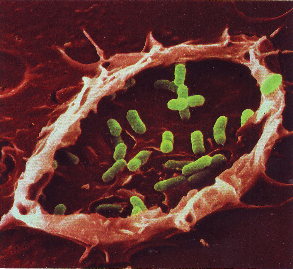 Bacteria Trap      Bacteria trapped within an extension of a macrophage membrane