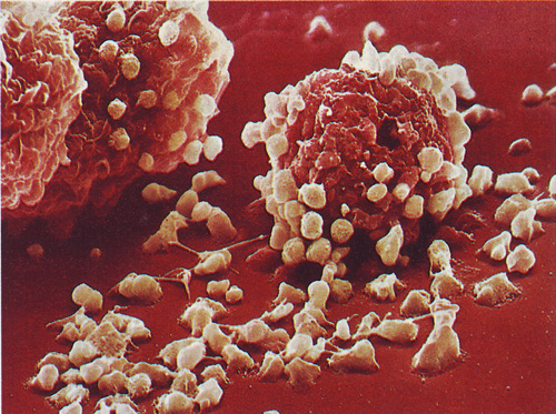 Overzealous        Overzealous immune responses, allergic reactions plague humans who produce certain unnecessary antibodies.