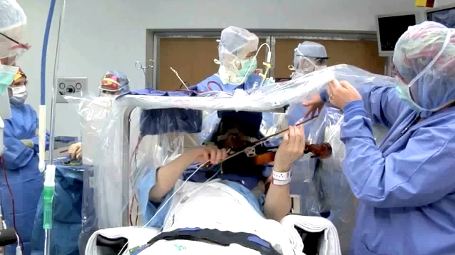 Violinist, Roger Frisch, plays during brain surgery to find whats causing his tremors