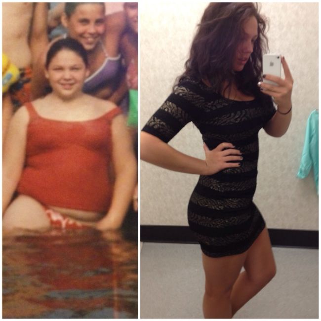 16 Awkward Girls Who Grew Up Hot