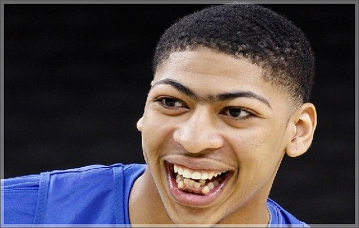 Anthony Davis’ teeth