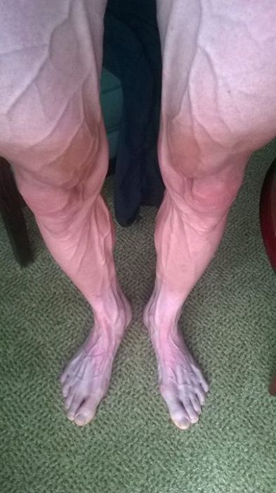 Bartosz Huzarski`s legs after 18th stage. Tour de France 2014