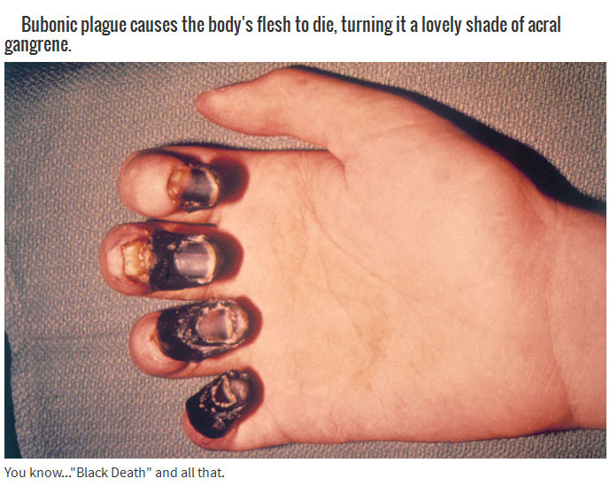 black death plague - Bubonic plague causes the body's flesh to die, turning it a lovely shade of acral gangrene. You know..."Black Death" and all that.
