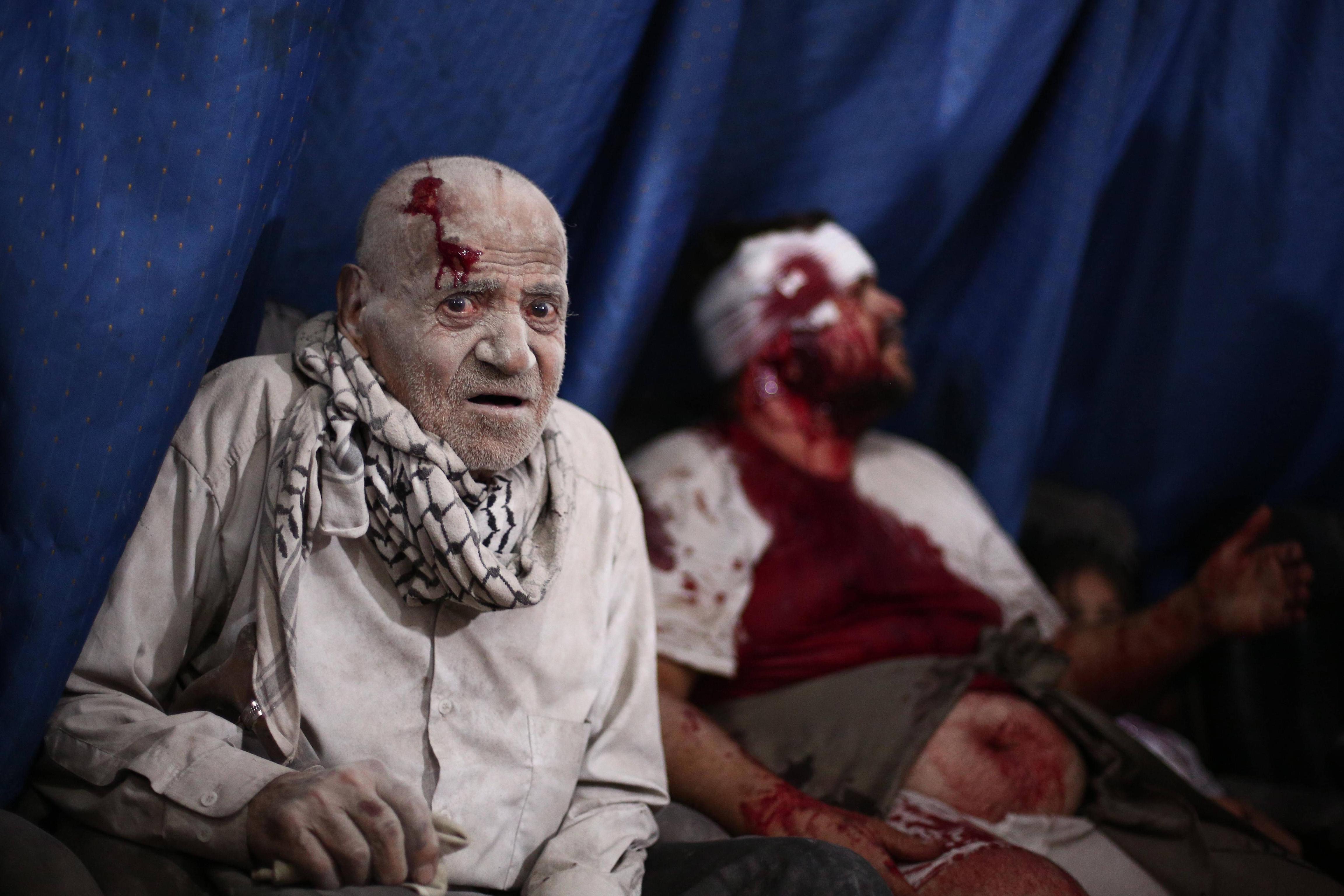 A terrified Syrian with haunted eyes waits for medical care after an airstrike
