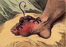 Help stamp out Gout! but don't stomp too hard lest you get the cap'n toe hurtin'! 