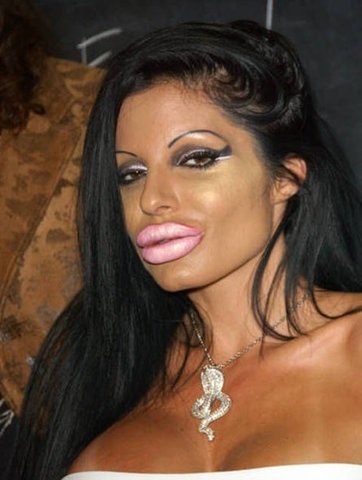 10 Cosmetic Surgery Epic Failures
