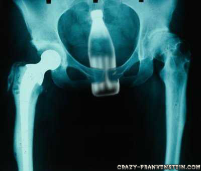 -|Gallery|- eBaums Picture Dump