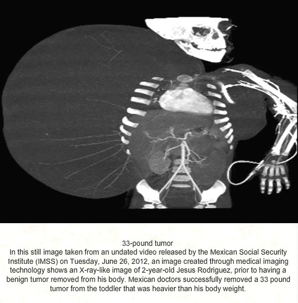 Medical Scans That Shock