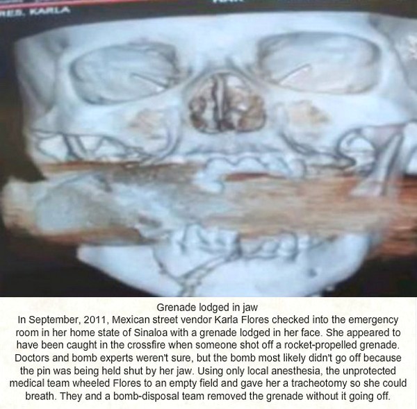 Medical Scans That Shock