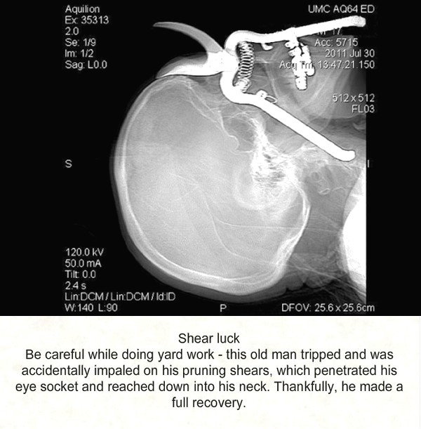 Medical Scans That Shock