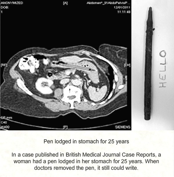 Medical Scans That Shock