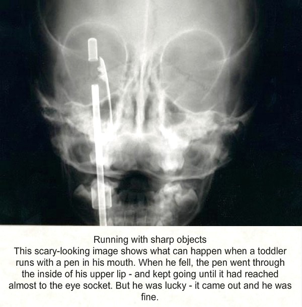 Medical Scans That Shock