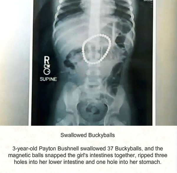 Medical Scans That Shock