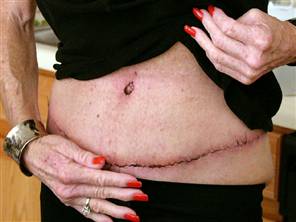 Groin Grabbing Funnies PLASTIC PEOPLE!!!!!!!!!!