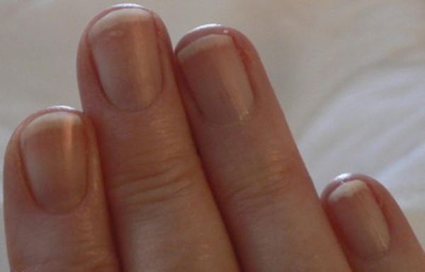 Lunule: The white, crescent shaped part at the top of a nail.
